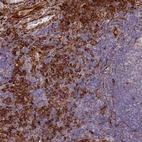 Immunohistochemical staining of human tonsil shows strong cytoplasmic positivity in non-germinal center cells.