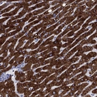 Immunohistochemical staining of human liver shows strong cytoplasmic positivity in hepatocytes.