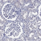 Immunohistochemical staining of human kidney shows no positivity in cells in glomeruli as expected.