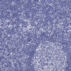Immunohistochemical staining of human lymph node shows no positivity in non-germinal center cells as expected.