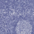 Immunohistochemical staining of human lymph node shows no positivity in non-germinal center cells as expected.