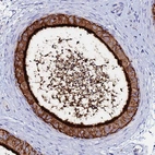 Immunohistochemical staining of human epididymis shows strong membranous positivity in glandular cells.