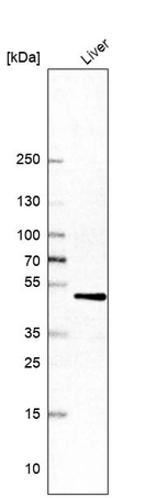 Western blot analysis in human liver tissue.