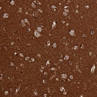 Immunohistochemical staining of human cerebral cortex shows strong positivity in neuropil.