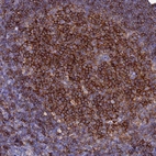 Immunohistochemical staining of human tonsil shows strong membranous positivity in germinal center cells.