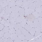 Immunohistochemical staining of human skeletal muscle shows no positivity in myocytes as expected.