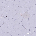 Immunohistochemical staining of human skeletal muscle shows no positivity in myocytes as expected.