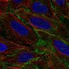 Immunofluorescent staining of human cell line SiHa shows localization to plasma membrane.