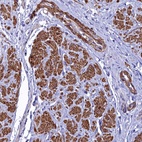 Anti-FADS3 Antibody