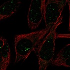 Immunofluorescent staining of human cell line RH-30 shows localization to nucleoli fibrillar center.