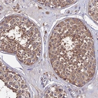 Anti-C2orf69 Antibody