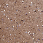 Immunohistochemical staining of human cerebral cortex shows moderate cytoplasmic positivity in neuropil.