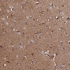 Immunohistochemical staining of human cerebral cortex shows moderate cytoplasmic positivity in neuropil.