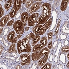Immunohistochemical staining of human kidney shows strong cytoplasmic positivity in cells in tubules.
