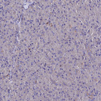 Immunohistochemical staining of human pancreas shows no positivity in exocrine glandular cells as expected.