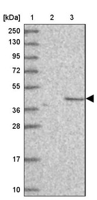 Lane 1: Marker [kDa] 250, 130, 95, 72, 55, 36, 28, 17, 10_br/_Lane 2: Human cell line RT-4_br/_Lane 3: Human cell line U-251MG sp