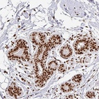 Anti-SIK3 Antibody
