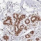 Anti-SIK3 Antibody
