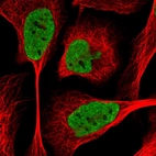 Immunofluorescent staining of human cell line U-2 OS shows localization to nucleoplasm.