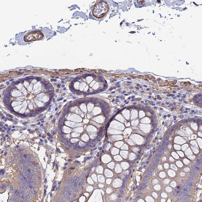 Anti-MYL12B Antibody