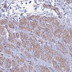 Anti-MYL12B Antibody