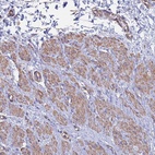 Anti-MYL12B Antibody