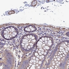 Anti-MYL12B Antibody