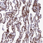Anti-COL6A6 Antibody