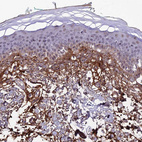 Immunohistochemical staining of human skin shows moderate positivity in extracellular matrix.