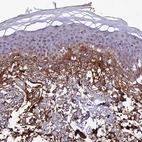 Immunohistochemical staining of human skin shows moderate positivity in extracellular matrix.