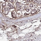 Immunohistochemical staining of human breast shows moderate positivity in extracellular matrix.