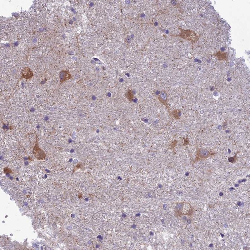 Anti-PCDHB14 Antibody