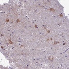 Anti-PCDHB14 Antibody