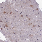 Anti-PCDHB14 Antibody