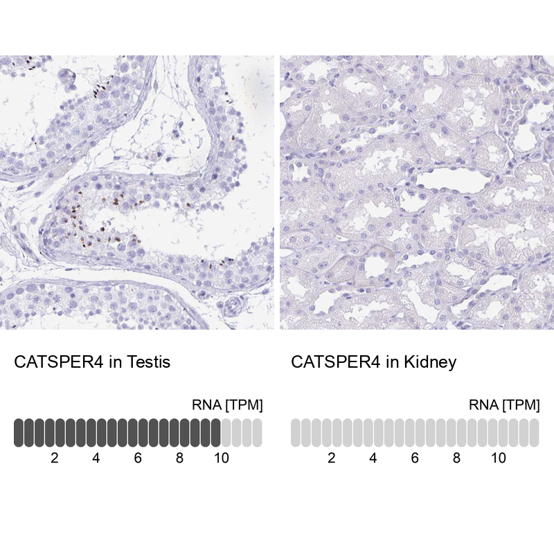 Anti-CATSPER4 Antibody