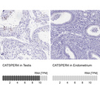 Anti-CATSPER4 Antibody