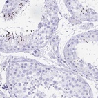 Immunohistochemical staining of human testis shows high expression.