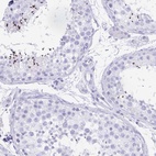 Anti-CATSPER4 Antibody