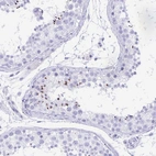 Immunohistochemical staining of human testis shows strong cytoplasmic positivity in subset of cells in seminiferous ducts.