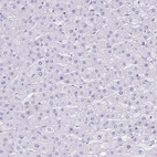 Immunohistochemical staining of human liver shows no positivity in hepatocytes.