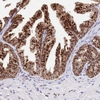 Immunohistochemical staining of human prostate shows strong nuclear positivity in glandular cells.