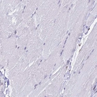 Immunohistochemical staining of human skeletal muscle shows no positivity in myocytes as expected.