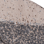 Immunohistochemical staining of human cerebellum shows moderate to strong nuclear positivity in cells in molecular layer.