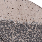 Immunohistochemical staining of human cerebellum shows moderate to strong nuclear positivity in cells in molecular layer.