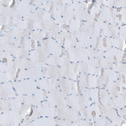 Immunohistochemical staining of human skeletal muscle shows no positivity in myocytes as expected.