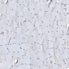 Immunohistochemical staining of human skeletal muscle shows no positivity in myocytes as expected.