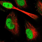 Immunofluorescent staining of human cell line U-251 MG shows localization to nucleoplasm.