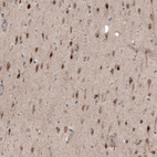 Immunohistochemical staining of human cerebral cortex shows moderate to strong nuclear positivity in neurons.