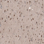 Immunohistochemical staining of human cerebral cortex shows moderate to strong nuclear positivity in neurons.