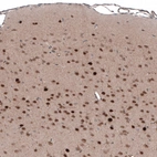 Immunohistochemical staining of mouse brain shows moderate to strong nuclear positivity in neurons.